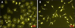 Lipopolysaccharides from Escherichia coli O111:B4, purified by phenol extraction