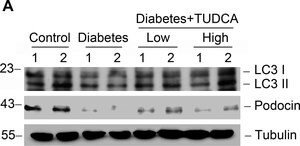 Monoclonal Anti-alpha-Tubulin antibody produced in mouse, clone B-5-1-2, purified immunoglobulin, buffered aqueous solution