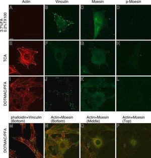 Monoclonal Anti-beta-Actin antibody produced in mouse, clone AC-15, ascites fluid