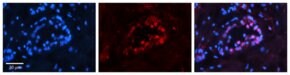 Anti-PAX8 antibody produced in rabbit, affinity isolated antibody