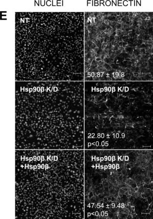 Monoclonal Anti-Fibronectin antibody produced in mouse, clone IST-4, ascites fluid