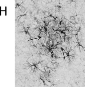 Monoclonal Anti-Glial Fibrillary Acidic Protein (GFAP) antibody produced in mouse, clone G-A-5, ascites fluid