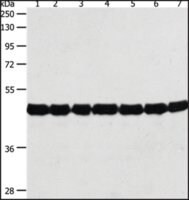 Anti-ACTIN antibody produced in rabbit, affinity isolated antibody