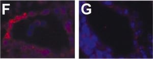 Monoclonal Anti-Actin, alpha-Smooth Muscle, clone 1A4, ascites fluid