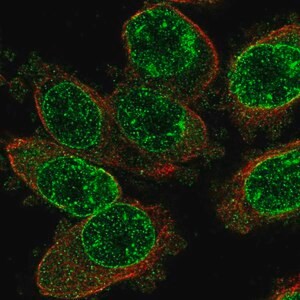 Anti-TRPM2 antibody produced in rabbit, Prestige Antibodies(R) Powered by Atlas Antibodies, affinity isolated antibody