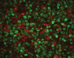 Anti-CD3, T Cell antibody produced in rabbit, whole antiserum