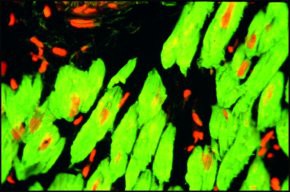 Monoclonal Anti-Troponin T antibody produced in mouse, clone JLT-12, ascites fluid