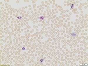 Leukocyte Alkaline Phosphatase Kit, based on naphthol AS-BI and fast red violet LB