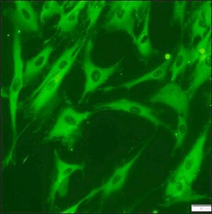 Anti-Vinculin-FITC antibody, Mouse monoclonal, clone hVIN-1, purified from hybridoma cell culture