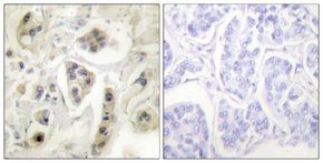 Anti-HSP60 antibody produced in rabbit, affinity isolated antibody