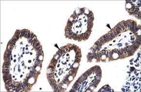 Anti-EGR2 antibody produced in rabbit, affinity isolated antibody