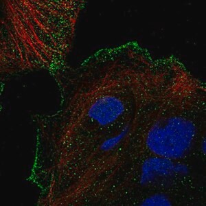 Anti-TRPV3 antibody produced in rabbit, Prestige Antibodies(R) Powered by Atlas Antibodies, affinity isolated antibody