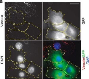 Monoclonal Anti-Vinculin antibody produced in mouse, clone VIN-11-5, ascites fluid