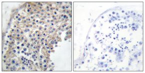 Anti-Adrenergic Receptor alpha-2A antibody produced in rabbit, affinity isolated antibody