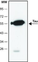 Anti-Tau antibody, Mouse monoclonal, clone Tau46, purified from hybridoma cell culture