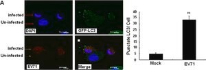 Anti-LC3B antibody produced in rabbit, ~1 mg/mL, affinity isolated antibody, buffered aqueous solution