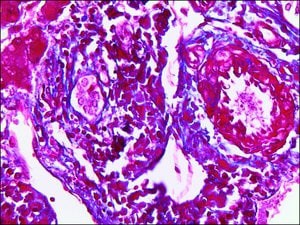 Trichrome Stain AB solution